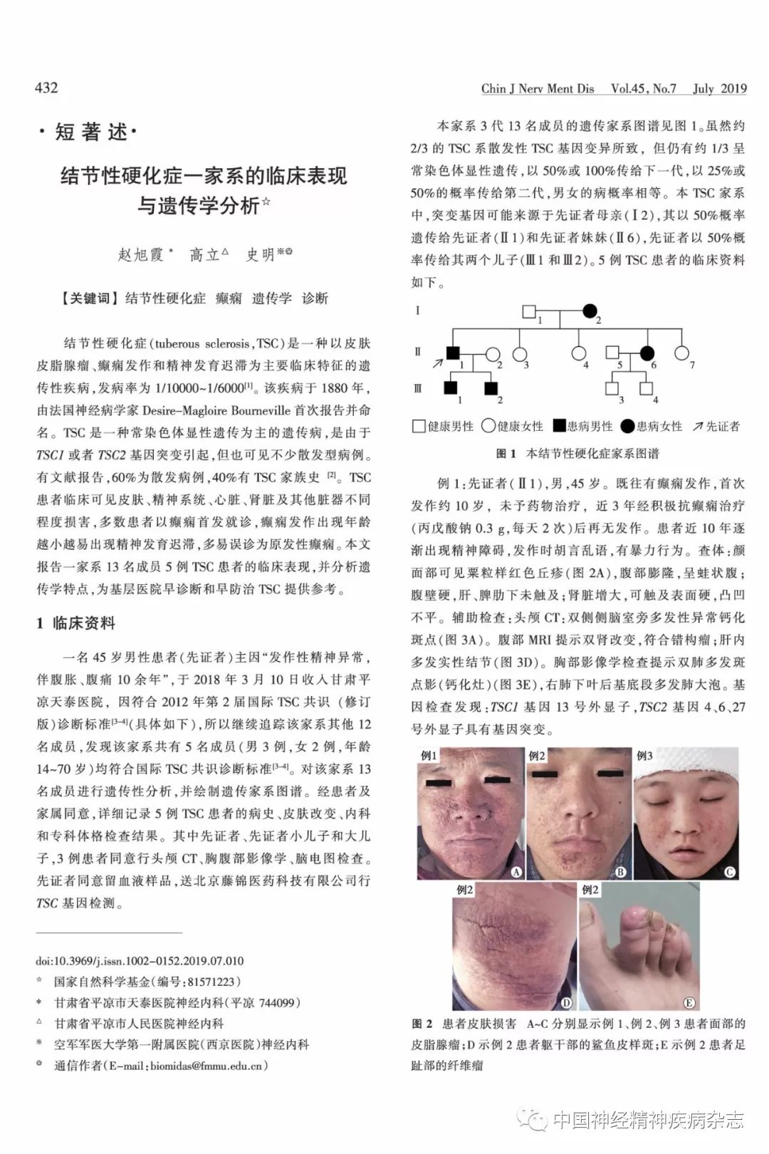 结节性硬化症最新药物研究突破与进展概述